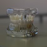 Prześliczne zdrowe zęby dodatkowo powalający przepiękny uśmieszek to powód do zadowolenia.